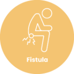 Fistula (1)