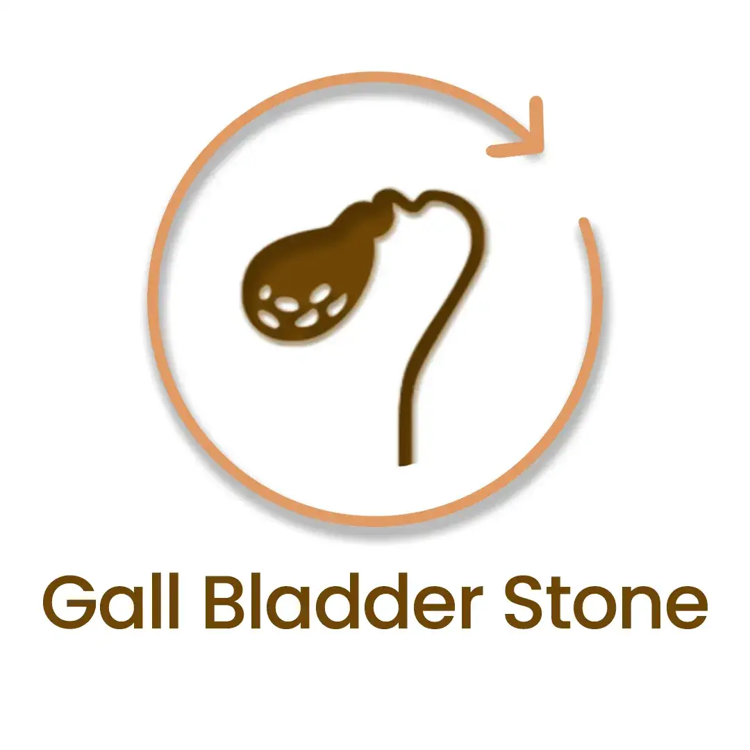 GB-Stone