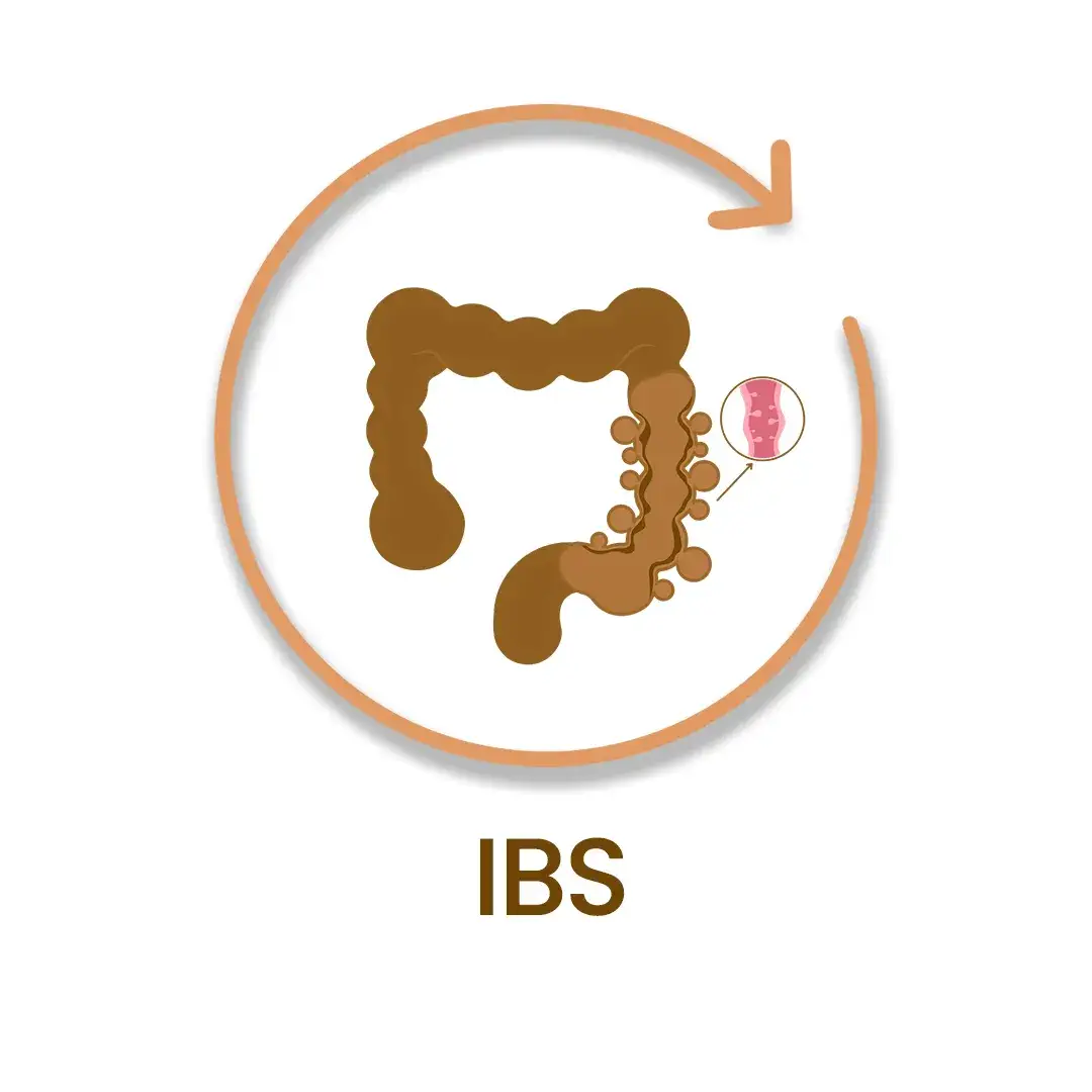 IBS illustrator